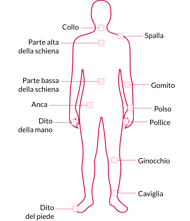 sintomi artrite psoriasica