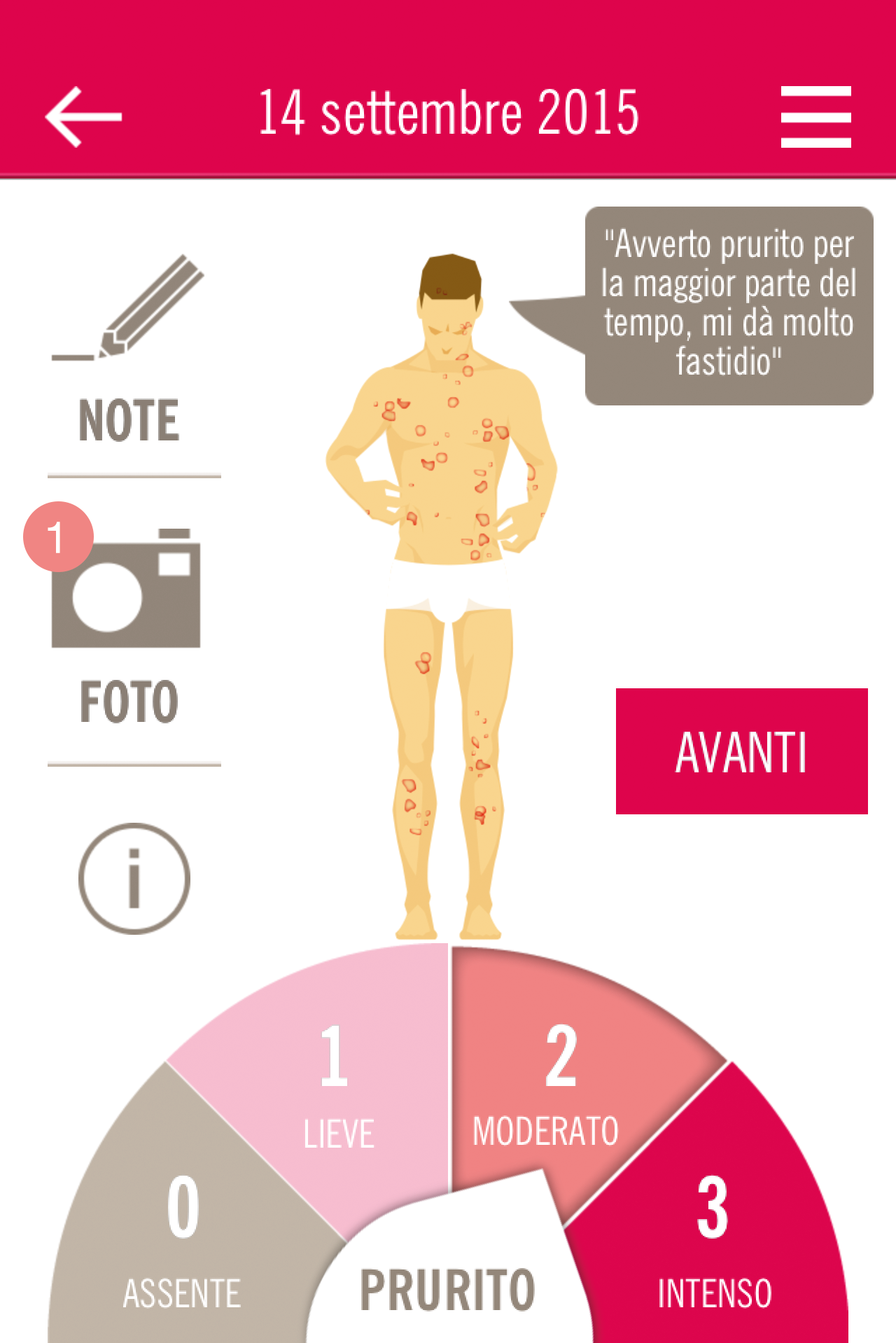 Prurito orticaria cronica uomo